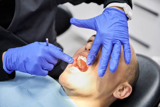 Best Emergency Root Canal Therapy in Madisonville, TX